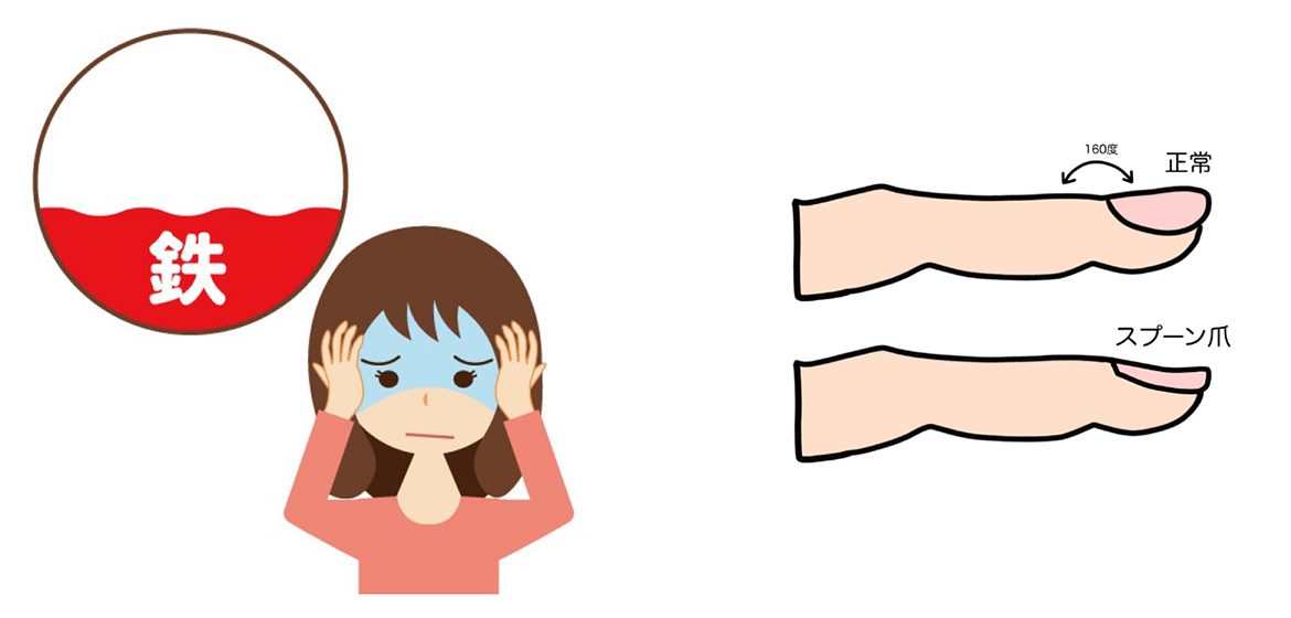 貧血の症状